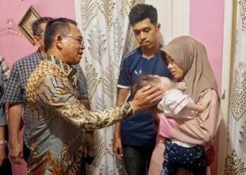 Mikhayla, Balita Yang Berjuang Melawan Kanker Mata, Mendapat Perhatian Khusus Dari Wakil Wali Kota Medan