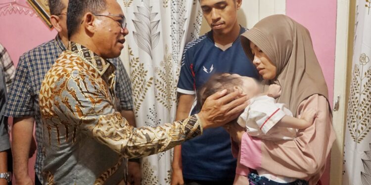 Mikhayla, Balita Yang Berjuang Melawan Kanker Mata, Mendapat Perhatian Khusus Dari Wakil Wali Kota Medan